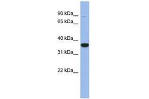 Image no. 1 for anti-Fanconi Anemia, Complementation Group L (FANCL) (AA 143-192) antibody (ABIN6744042)