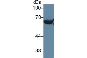 Image no. 2 for Lecithin-Cholesterol Acyltransferase (LCAT) ELISA Kit (ABIN6720598)