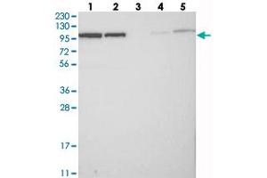 Image no. 1 for anti-Bicaudal D Homolog 2 (BICD2) antibody (ABIN5649412)