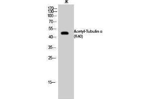 Image no. 1 for anti-alpha Tubulin (TUBA1) (acLys40) antibody (ABIN3181895)