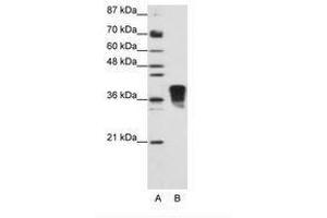 Image no. 2 for anti-Transformer 2 beta Homolog (TRA2B) (N-Term) antibody (ABIN202162)