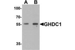 Image no. 1 for anti-GH3 Domain Containing (GHDC) (N-Term) antibody (ABIN1450039)