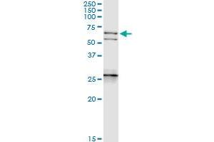 Image no. 2 for anti-Neurofilament, Light Polypeptide (NEFL) (AA 1-543) antibody (ABIN518281)