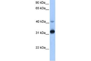 Image no. 1 for anti-Trans-2,3-Enoyl-CoA Reductase (TECR) (Middle Region) antibody (ABIN2783368)