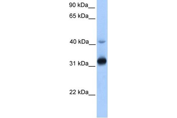 anti-Trans-2,3-Enoyl-CoA Reductase (TECR) (Middle Region) antibody