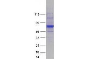 Image no. 1 for tyrosine Aminotransferase (TAT) protein (Myc-DYKDDDDK Tag) (ABIN2733246)