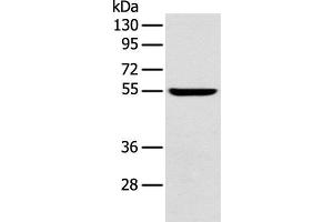 Western blot analysis of Mouse brain tissue using FOXG1 Polyclonal Antibody at dilution of 1:550