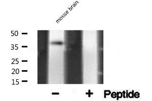 Image no. 1 for anti-Aldolase A, Fructose-Bisphosphate (ALDOA) (N-Term) antibody (ABIN6259883)