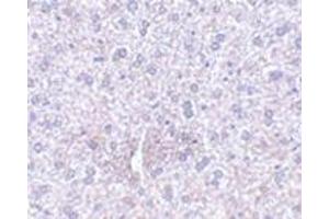 Image no. 1 for anti-Plexin Domain Containing 1 (PLXDC1) (Center) antibody (ABIN500901)