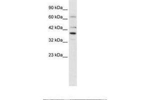 Image no. 2 for anti-POU Domain, Class 4, Transcription Factor 3 (POU4F3) (AA 211-260) antibody (ABIN202275)