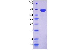 Image no. 1 for Cadherin 5 (CDH5) (AA 67-390) protein (T7 tag,His tag) (ABIN6237725)