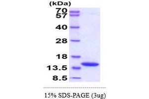Image no. 1 for D-Dopachrome Tautomerase (DDT) (AA 21-248) protein (His tag) (ABIN5855098)