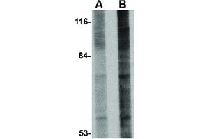 anti-GLE1 RNA Export Mediator (GLE1) (Internal Region) antibody