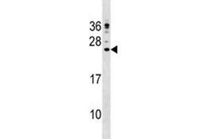 Image no. 2 for anti-Cathelicidin Antimicrobial Peptide (CAMP) (AA 123-152) antibody (ABIN3028580)
