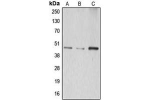Image no. 1 for anti-Abhydrolase Domain Containing 8 (ABHD8) (Center) antibody (ABIN2705380)