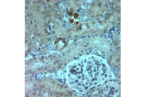 Image no. 1 for anti-Aquaporin 6, Kidney Specific (AQP6) (C-Term) antibody (ABIN571715)