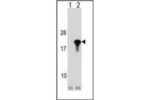 Image no. 1 for anti-Peptidylprolyl Isomerase (Cyclophilin)-Like 1 (PPIL1) (AA 62-91), (Middle Region) antibody (ABIN954267)