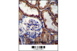 Image no. 1 for anti-Wingless-Type MMTV Integration Site Family, Member 16 (WNT16) (AA 236-265), (C-Term) antibody (ABIN657146)