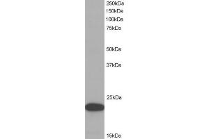Image no. 2 for anti-PYD and CARD Domain Containing (PYCARD) (C-Term) antibody (ABIN184674)