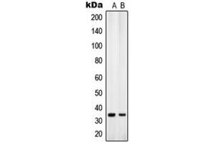 Image no. 2 for anti-Solute Carrier Family 25 (Mitochondrial Carrier, Adenine Nucleotide Translocator), Member 31 (SLC25A31) (Center) antibody (ABIN2705476)