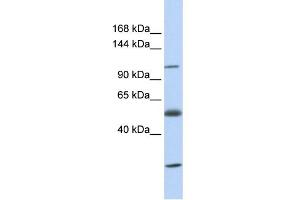 Image no. 1 for anti-Solute Carrier Family 39 (Zinc Transporter), Member 10 (SLC39A10) (N-Term) antibody (ABIN2781666)