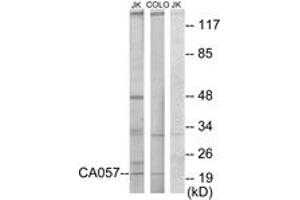 Image no. 1 for anti-Nucleoside-Triphosphatase, Cancer-Related (NTPCR) (AA 141-190) antibody (ABIN1534092)