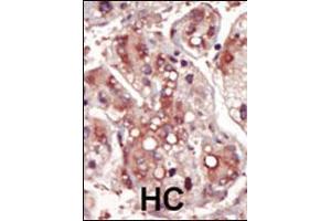 Image no. 3 for anti-Mitogen-Activated Protein Kinase Kinase 2 (MAP2K2) (AA 262-292) antibody (ABIN392485)
