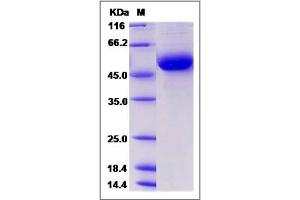 Image no. 1 for Discoidin Domain Receptor tyrosine Kinase 1 (DDR1) (AA 1-413) protein (His tag) (ABIN2009624)