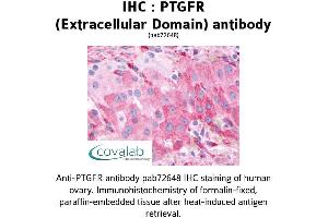 Image no. 1 for anti-Prostaglandin F Receptor (FP) (PTGFR) (1st Extracellular Domain) antibody (ABIN1738570)