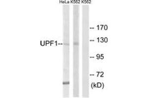 Image no. 1 for anti-UPF1 Regulator of Nonsense Transcripts Homolog (UPF1) (AA 299-348) antibody (ABIN1535287)