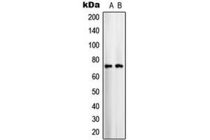 Image no. 2 for anti-Solute Carrier Family 25 (Mitochondrial Carrier, Aralar), Member 12 (Slc25a12) (Center) antibody (ABIN2705500)