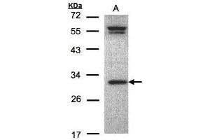 Image no. 2 for anti-Origin Recognition Complex, Subunit 6 (ORC6) (C-Term) antibody (ABIN2855901)