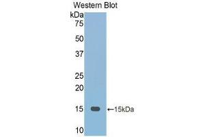 Image no. 1 for anti-Fetuin B (FETUB) (AA 152-261) antibody (ABIN1175110)