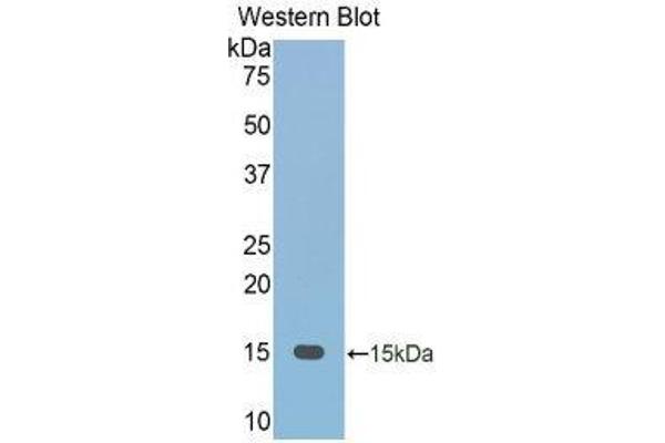 FETUB antibody  (AA 152-261)