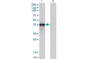 Image no. 2 for anti-Nephroblastoma Overexpressed (NOV) (AA 1-357) antibody (ABIN518410)