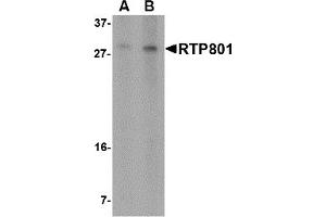 Image no. 1 for anti-DNA-Damage-Inducible Transcript 4 (DDIT4) (N-Term) antibody (ABIN1031547)