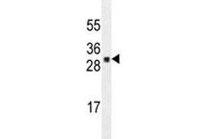 Image no. 2 for anti-Ubiquitin Domain Containing 1 (UBTD1) antibody (ABIN3029432)