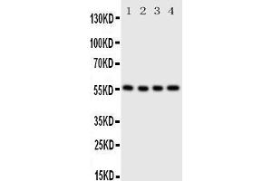 Image no. 1 for anti-Solute Carrier Family 2 (Facilitated Glucose/fructose Transporter), Member 5 (SLC2A5) (AA 481-501), (C-Term) antibody (ABIN3042923)