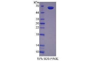 Image no. 1 for Secernin 1 (SCRN1) (AA 2-414) protein (His tag) (ABIN6239207)
