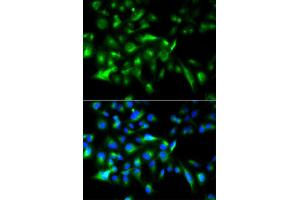 Immunofluorescence analysis of HeLa cell using MYD88 antibody.