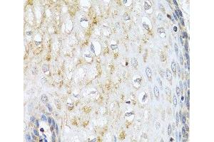 Immunohistochemistry of paraffin-embedded Human esophagus using NMU Polyclonal Antibody at dilution of 1:100 (40x lens).