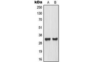 Image no. 3 for anti-MAX-Like Protein X (MLX) (Center) antibody (ABIN2707153)