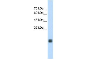 Image no. 1 for anti-Transmembrane Protein 178A (TMEM178A) (Middle Region) antibody (ABIN630480)