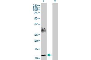 anti-SPEG Complex Locus (SPEG) (AA 1-113) antibody
