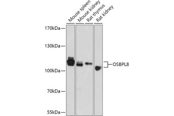 OSBPL8 Antikörper  (AA 1-110)