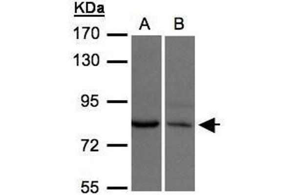anti-Xenotropic and Polytropic Retrovirus Receptor 1 (xpr1) (N-Term) antibody