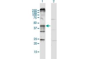 Image no. 1 for anti-Potassium Intermediate/small Conductance Calcium-Activated Channel, Subfamily N, Member 4 (KCNN4) (AA 1-427) antibody (ABIN948056)