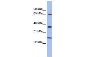 Image no. 1 for anti-HORMA Domain Containing 2 (HORMAD2) (Middle Region) antibody (ABIN630566)