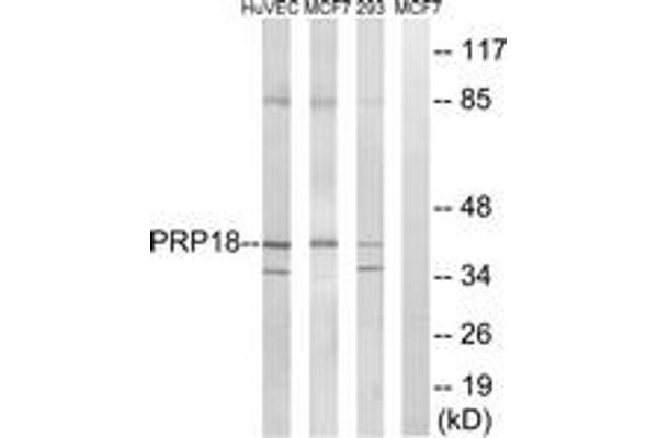 anti-PRP18 Pre-mRNA Processing Factor 18 (PRPF18) (AA 182-231) antibody