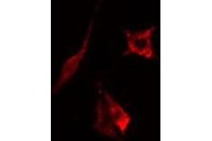 Image no. 1 for anti-Major Histocompatibility Complex, Class II, DO beta (HLA-DOB) antibody (ABIN6257256)
